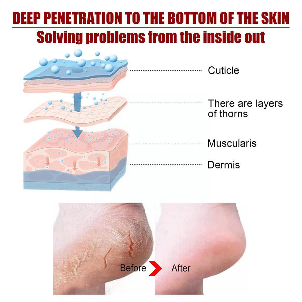 Exfoliating Foot Mask - Unlock the Secret to Soft, Beautiful Feet