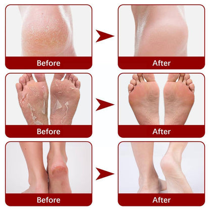 Exfoliating Foot Mask - Unlock the Secret to Soft, Beautiful Feet