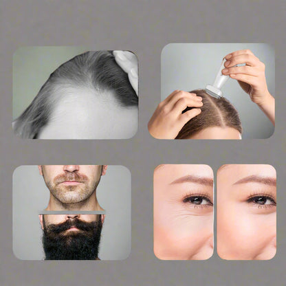 Microneedle Roller Derma Stamp – 0.25mm Roller for Face, Beard, and Scalp, Skin Rejuvenation Tool for Hair Growth and Anti-Aging