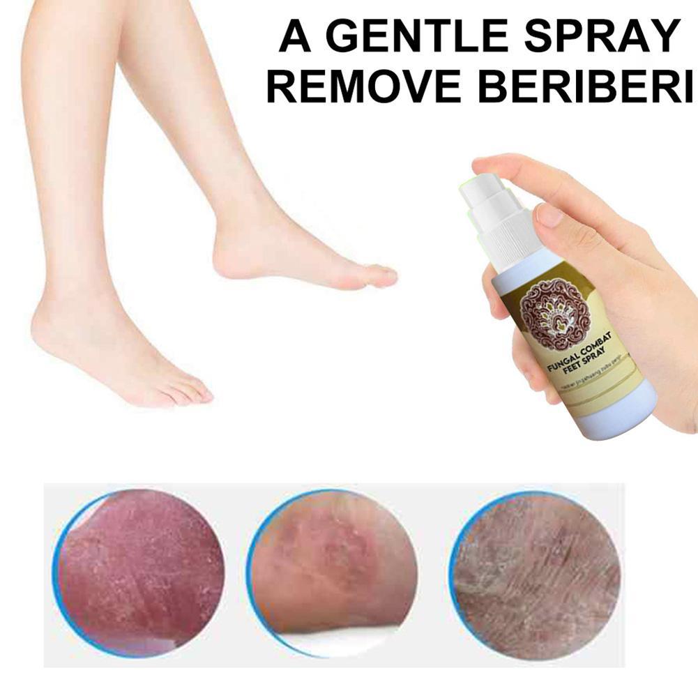 Fungal Treatment Foot Spray