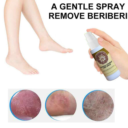 Fungal Treatment Foot Spray