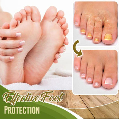 Fungal Treatment Foot Spray