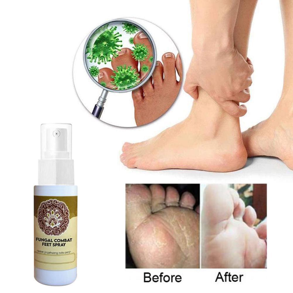 Fungal Treatment Foot Spray