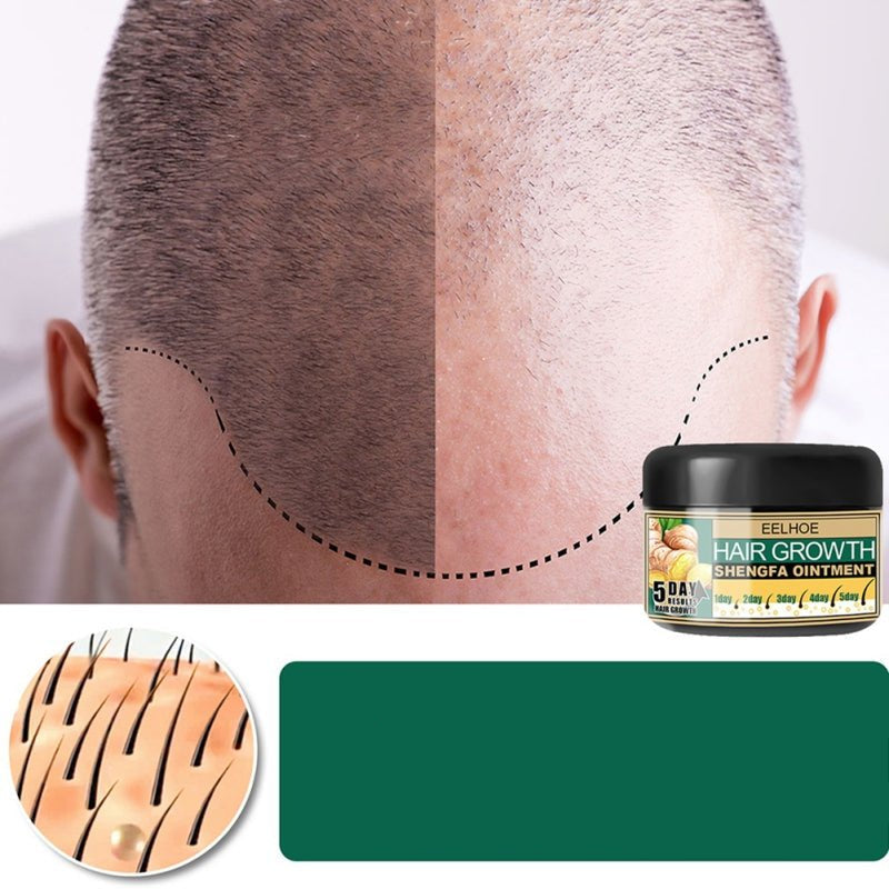 Ginger Hair Growth Cream – Natural Hair Loss Treatment