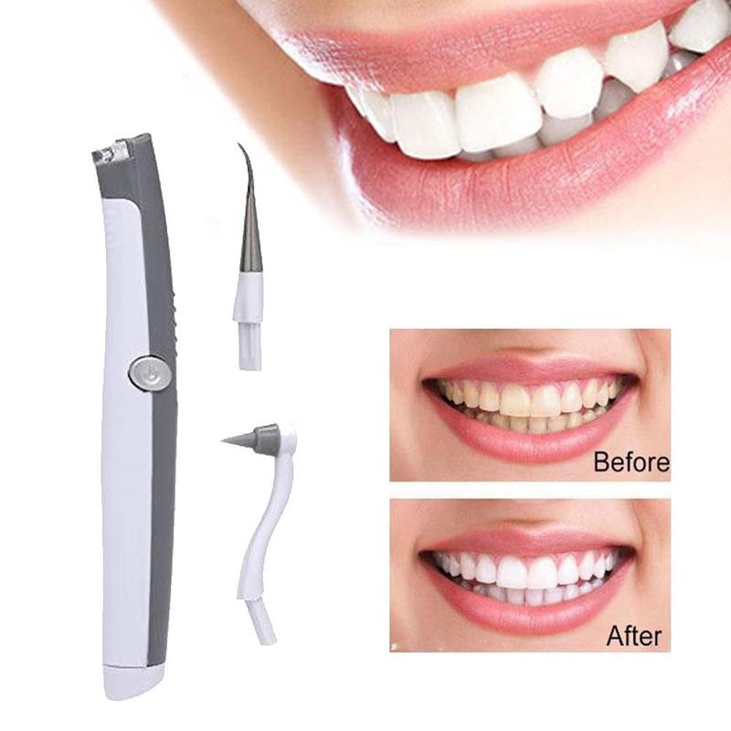 ELECTRIC SONIC TOOTH STAIN & PLAQUE REMOVER