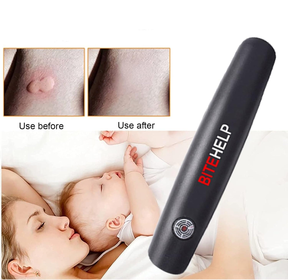 Insect Bite Suction - Instant Mosquito Bite Relief