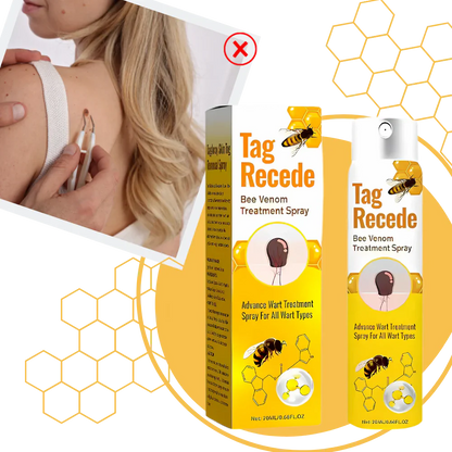 Non-Invasive Tag Recede