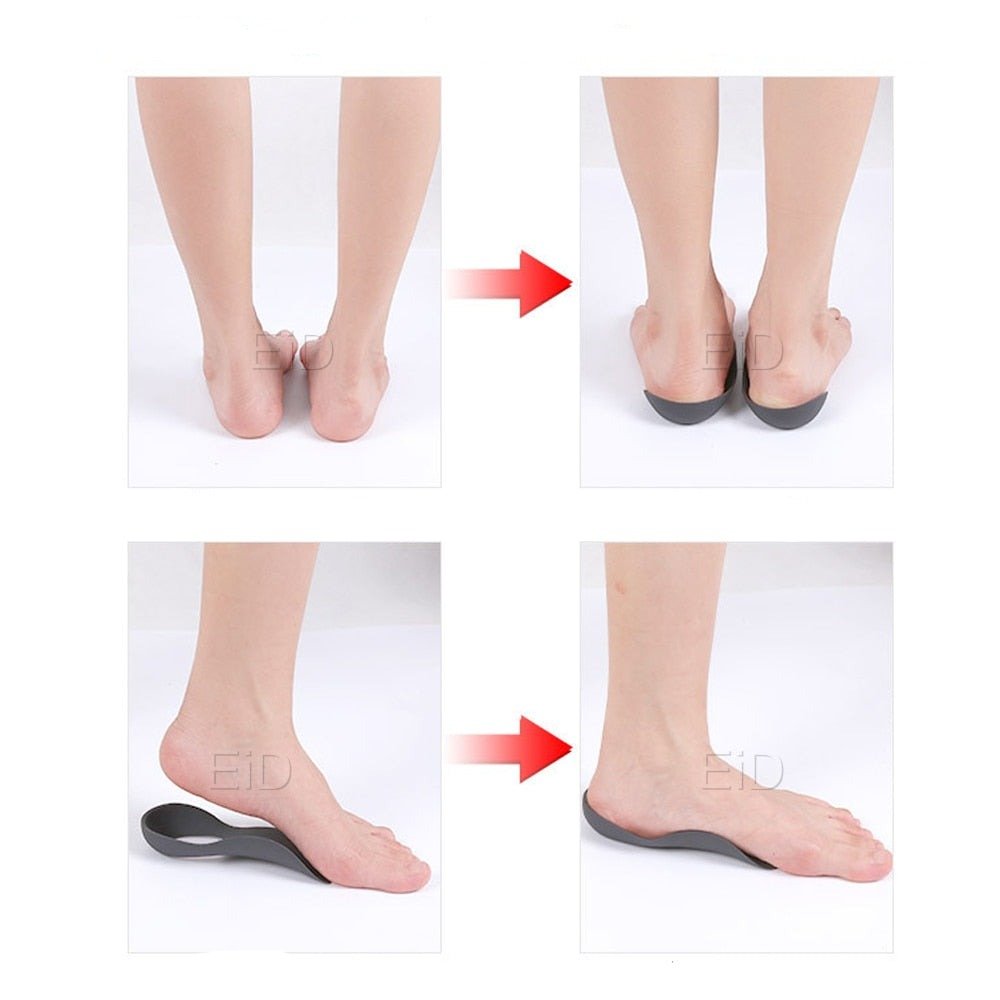 Orthopedic Insoles — 3/4 Length Arch Support Inserts for Plantar Fasciitis (1 Pair)