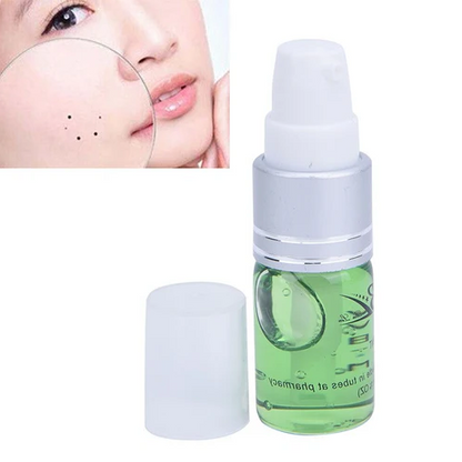 Moles Formula