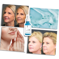 Rejuvenating Hyalu B5 Hyaluronic Acid Serum