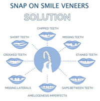 Smile Veneer (Upper & Lower Included)