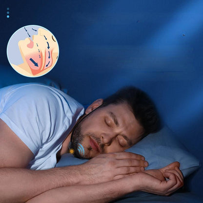 Portable Smart Anti-Snoring Device – USB Rechargeable Aid for Comfortable, Snore-Free Sleep and Sleep Apnea Relief
