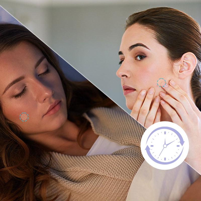 Wild+ Invisible Acne Patch